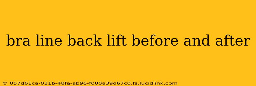 bra line back lift before and after