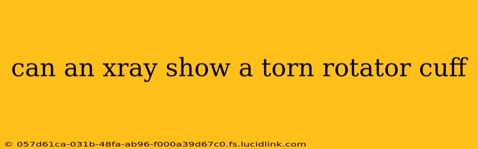 can an xray show a torn rotator cuff