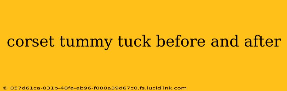 corset tummy tuck before and after