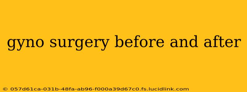 gyno surgery before and after