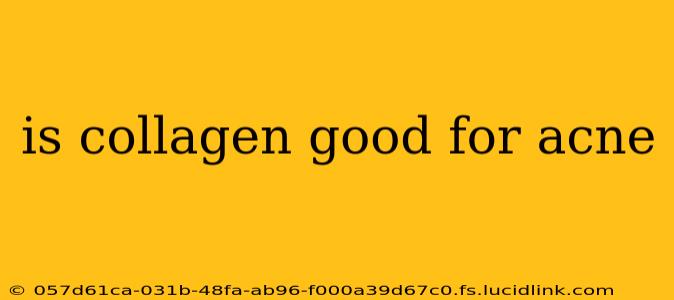 is collagen good for acne