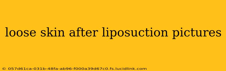 loose skin after liposuction pictures