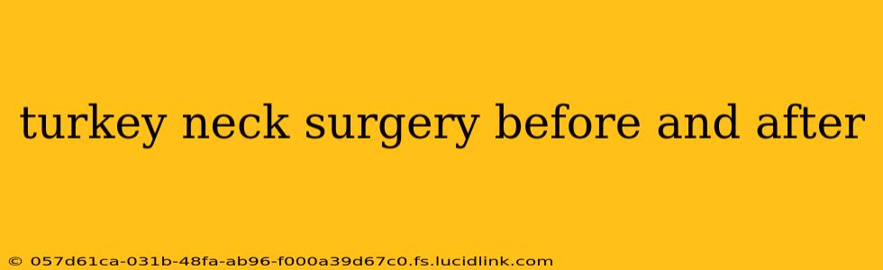 turkey neck surgery before and after