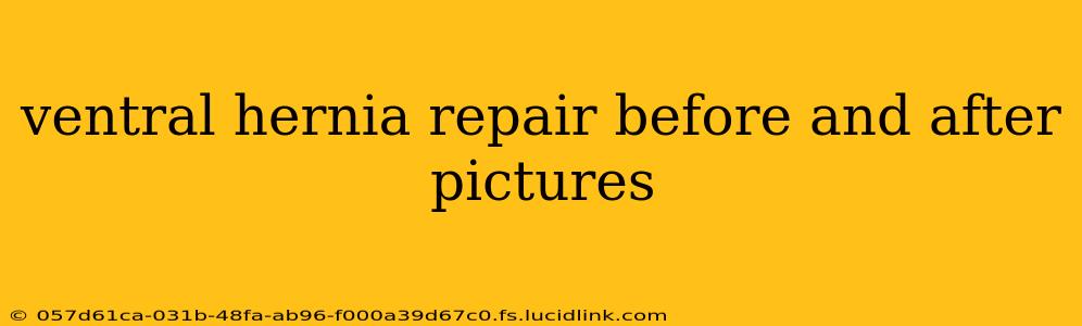ventral hernia repair before and after pictures